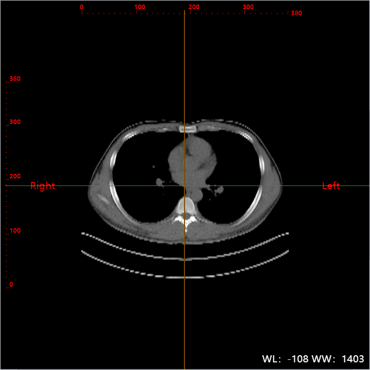 Ver imágenes médicas de alta resolución con una claridad incomparable mejora la precisión del diagnóstico.