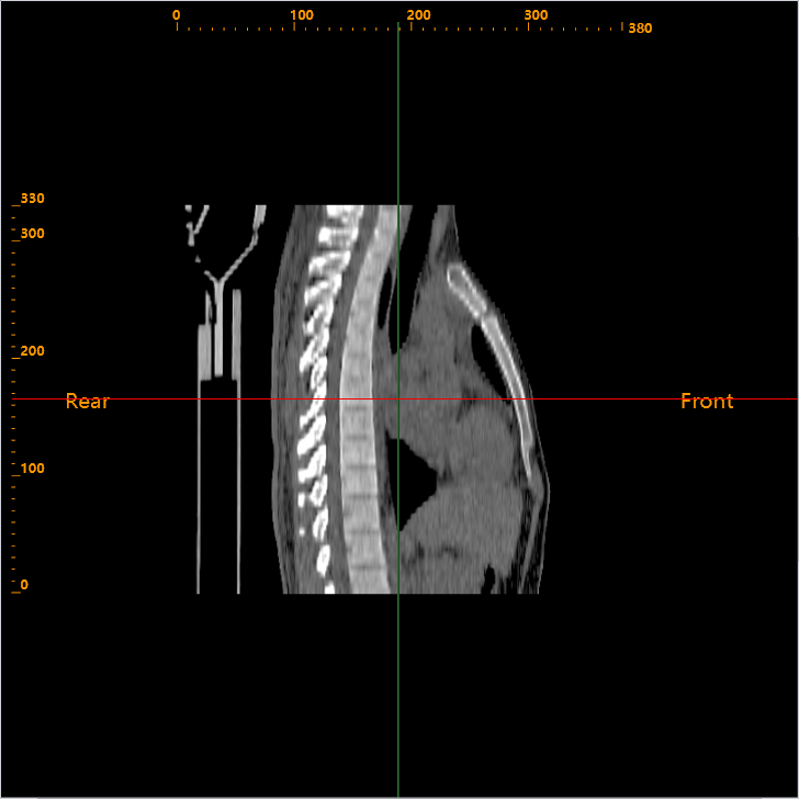 A web browser is all it takes to run 3DPEA DICOM Viewer. Whether you are at your workstation or at another station, there is no waste of time.