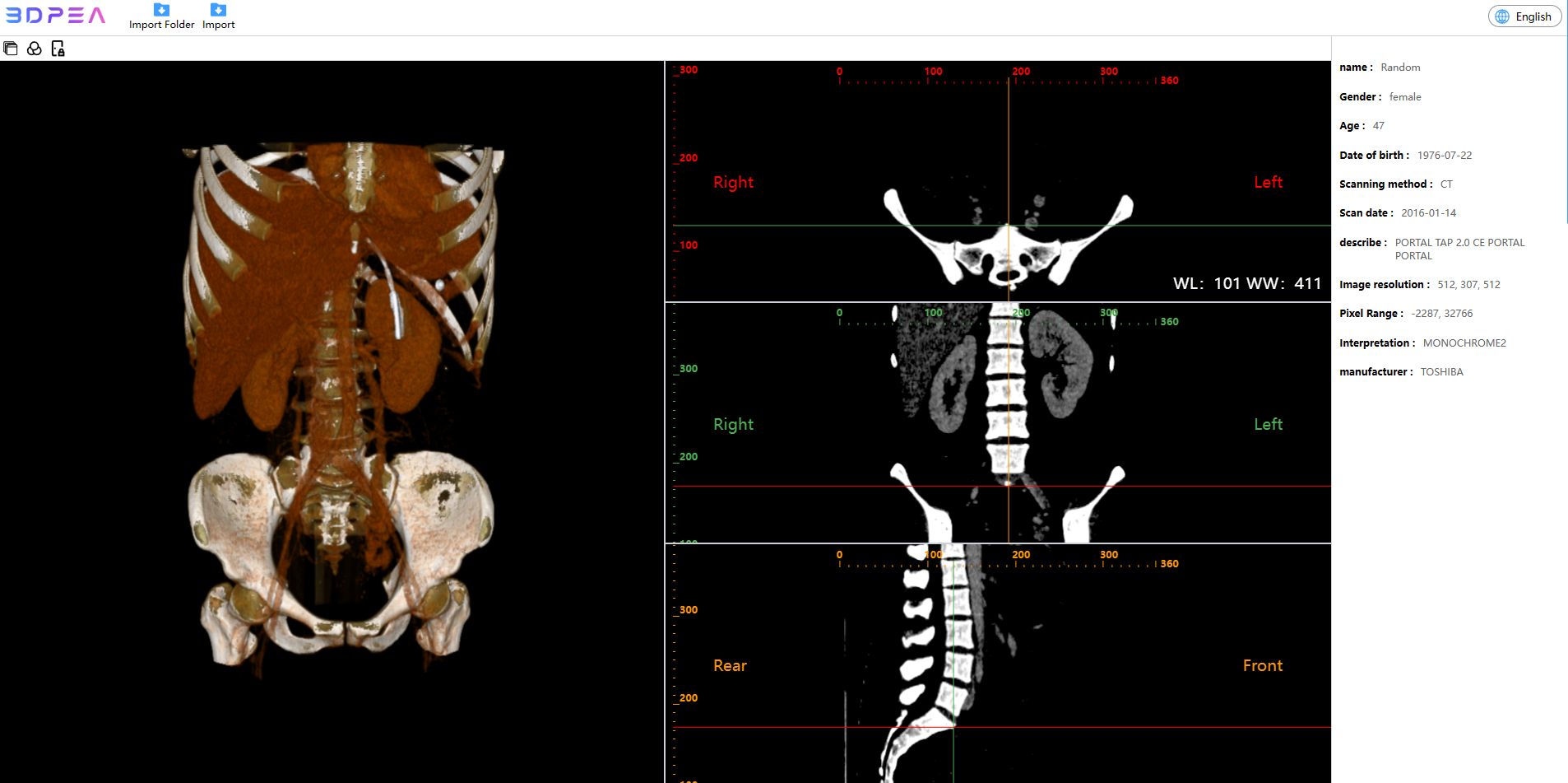 ด้วยการออกแบบที่ใช้งานง่าย 3DPEA DICOM Viewer ใช้งานง่ายแม้สำหรับผู้ที่มีทักษะทางเทคนิค จำกัด