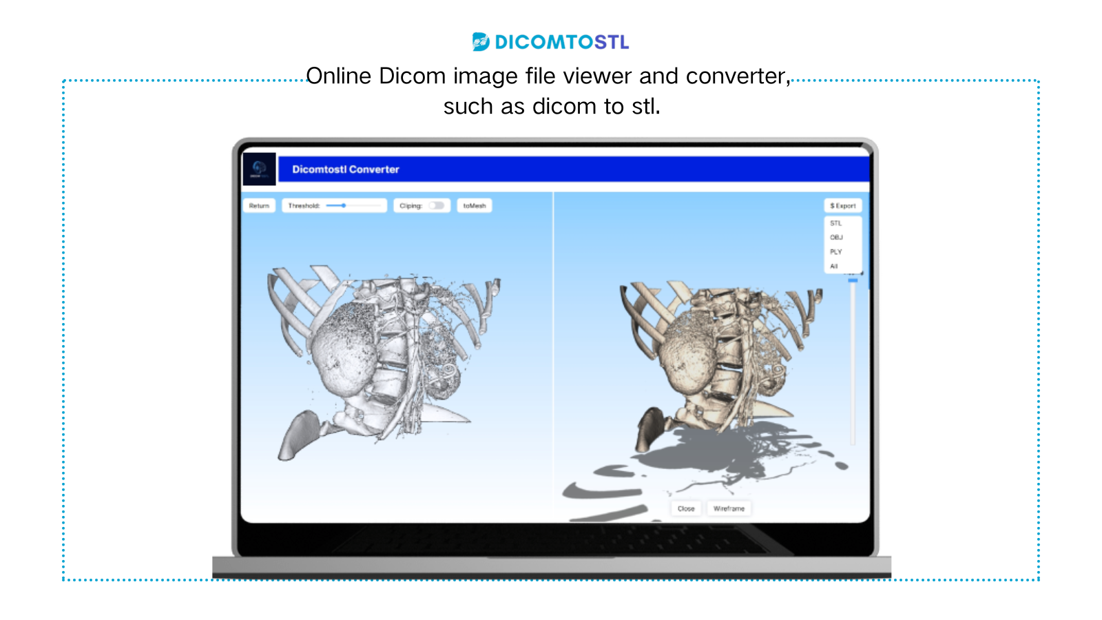 DICOM to STL Converter Online - Medical 3D Model Generator